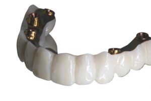 PMMA Teeth